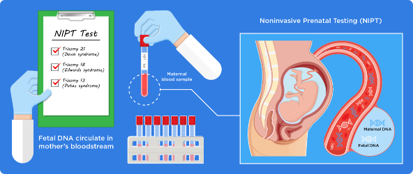 NIPT_infographic