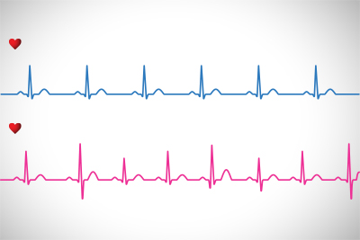 fetal heart rate at 12 weeks gender prediction