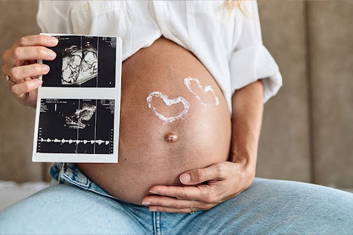 How to Test Gender for Twins
